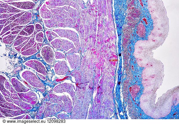 Human Esophagus Or Oesophagus Showing Squamous Epithelium Stratified