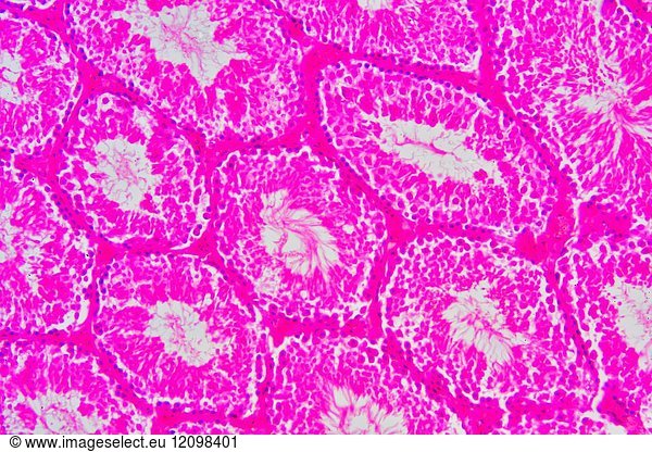 Human Testicle Or Testis Section Showing Seminiferous Tubules Human