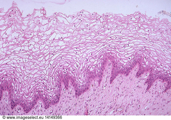 Labia Minora Lm Labia Minora Lm Female Female Reproductive System