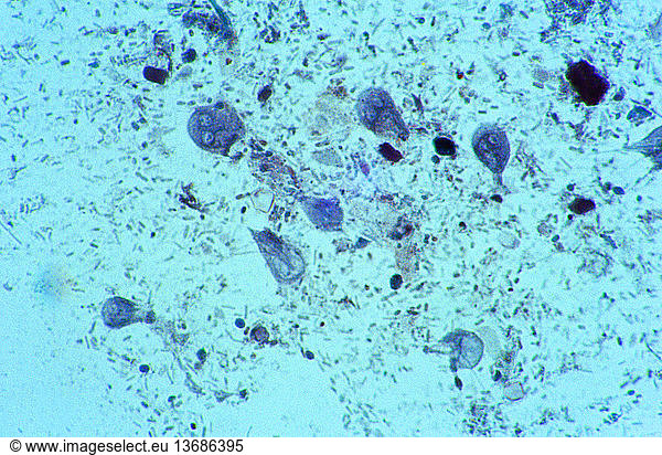 Light Micrograph Of Cysts Of Giardia Lamblia Light Micrograph Of Cysts