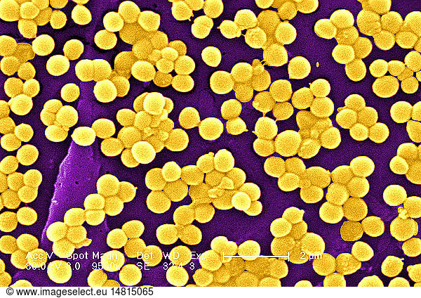 Staphylococcus Aureus Sem Staphylococcus Aureus Sem Aureus Bsip Carr