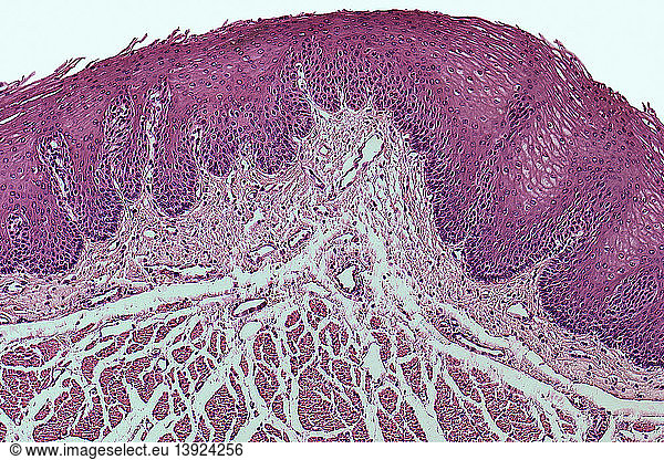 Stratified Squamous Epithelium Mucosa Stratified Squamous Epithelium