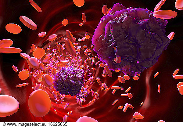 3D gerenderte Illustration von Leukämiezellen im Blutstrom