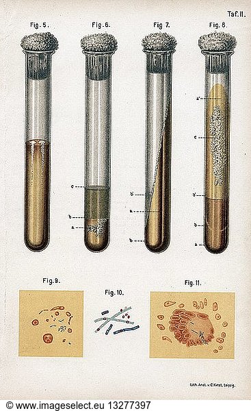 5:Pneumonia culture. 6 Albumen from rotten egg. 7& 8:Tuberculosis as prepared by Koch. 9:Sputum from TB patient. 10: Anthrax bacillus. 11:TB bacillus stained blue. From Ferdinand Hueppe 'Die die Methoden der Backtierien-Forschung'  Wiesbaden  1889. Hueppe worked with Koch.