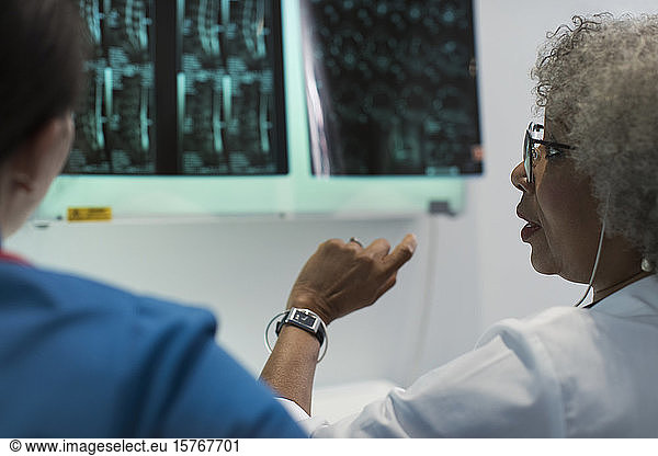 Ärztinnen besprechen Röntgenbilder im Krankenhaus