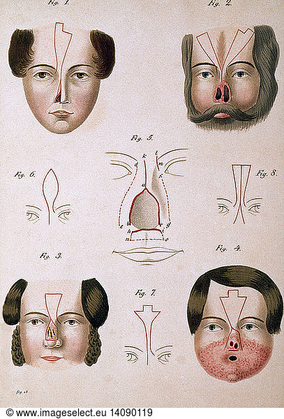 19th Century Facial Reconstruction