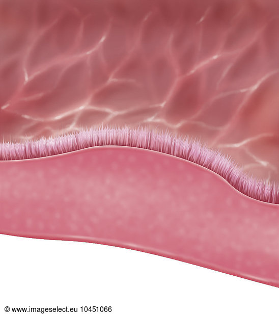 A cross-section illustration of the sinus mucous membrane A cross ...