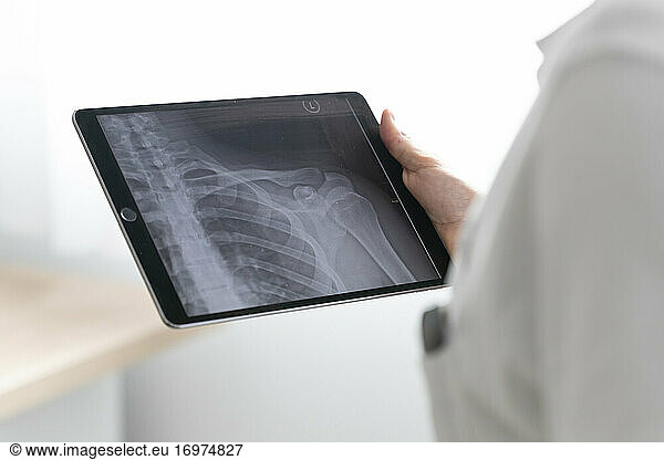 a healthcare professional looks at the x-ray of a shoulder on a tablet