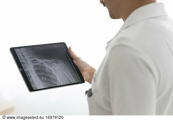 a healthcare professional looks at the x-ray of a shoulder on a tablet