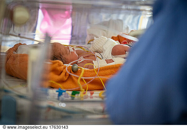 A nurse provides care to a premature baby.