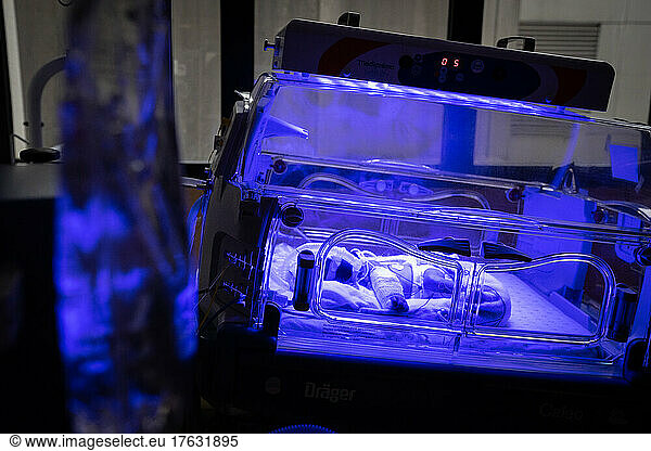 A premature baby is placed under blue light to treat jaundice.