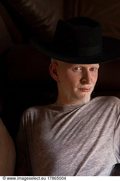Albino man portrait looking at the camera