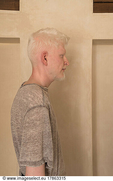 Albino man standing by the wall side portrait