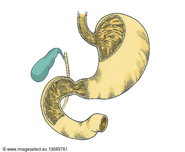 Anatomical illustration of the stomach and duodenum Anatomical ...