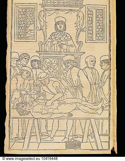Autopsy in Fasciculus Medicinae by Johannes de Ketham  1491  illustration