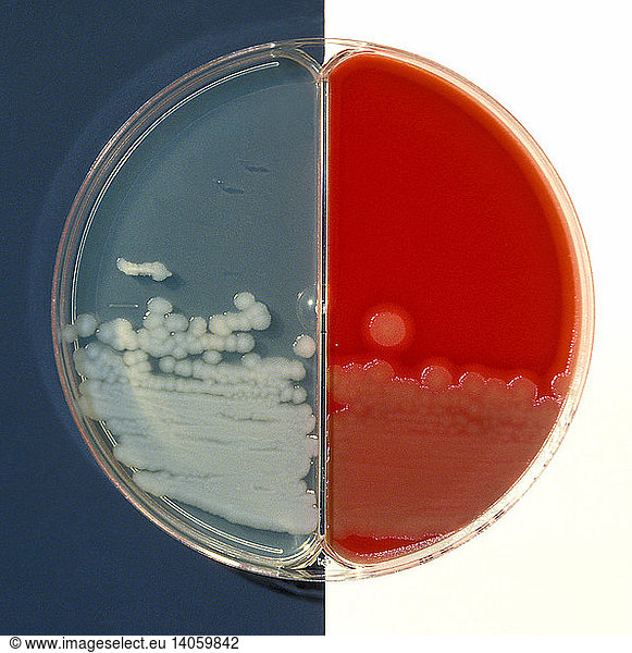 Bacillus Cereus Culture Bacillus Cereus Culture,agar,b Cereus,b. Cereus ...