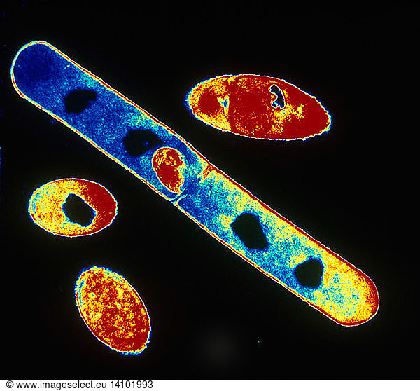 Bacillus subtilis bacteria bacillus subtilis bacteria tem abnormal