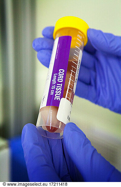 Biobank  tube containing umbilical cord stem cells (mesenchymal stem cells).