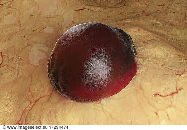 Blood on human tissue Blood on human tissue,color image,illustration,3D ...