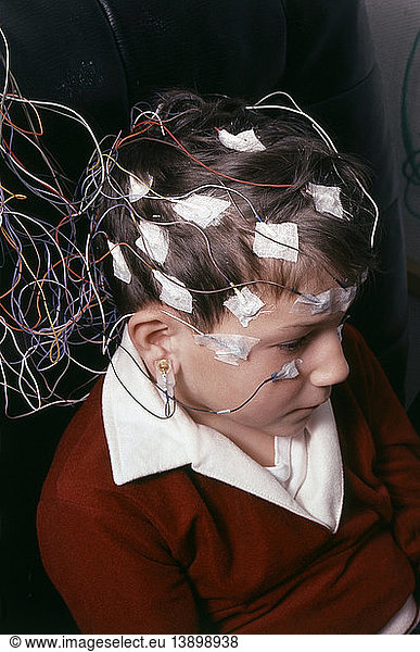 brain-electrical-activity-mapping-brain-electrical-activity-mapping