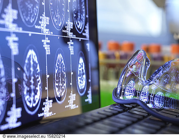 Brain scan results reflecting in protective glasses lying on laptop keyboard