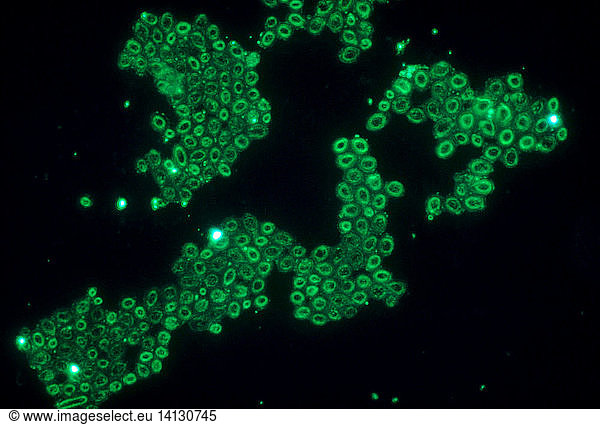 Candida albicans Candida albicans,ascomycota,candida,candidiasis ...