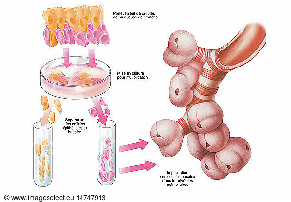 Cell therapy illustration