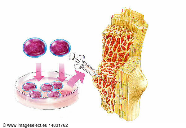 Cell therapy illustration