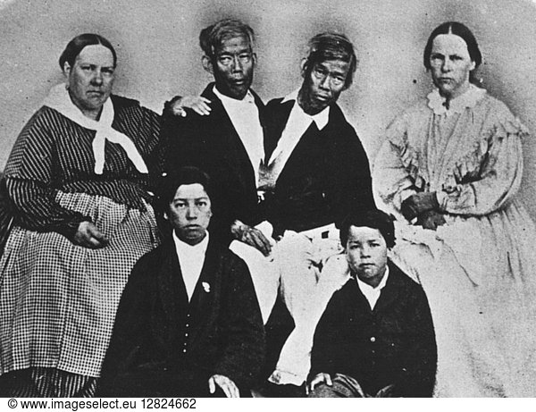 CHANG AND ENG (1811-1874). The original Siamese Twins. The twins with ...