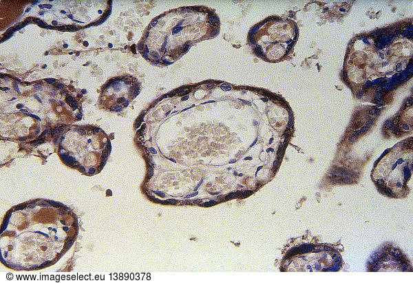 Chorionic Villi from Term Placenta (LM)
