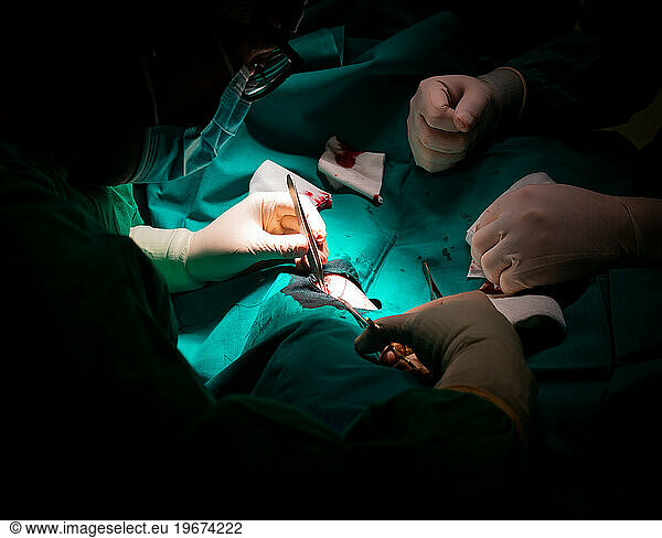Close-up of a surgeon's hands stitching a patient's skin incision.