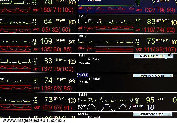 Close-up of EKG screen display