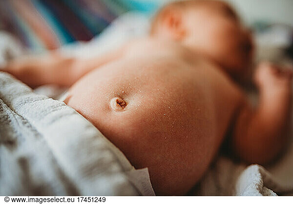 Close up of newborn baby belly button and dry skin