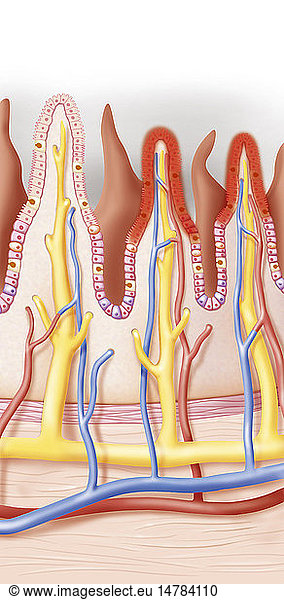 COELIAC DISEASE