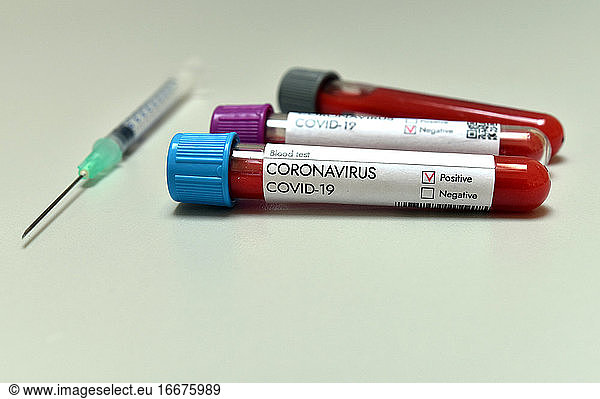 Coronavirus Covid 19 infected positive result blood test sample