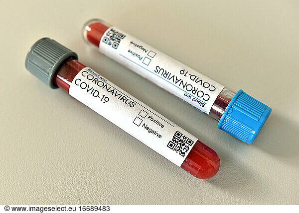 Coronavirus Covid 19 infiziert positives Ergebnis einer Blutprobe