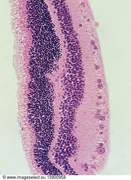 Cow Retina Cow Retina, Lm,choroid,ocular,ganglia - Rights Managed 