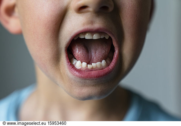 Crop view of little boy showing his milk teeth