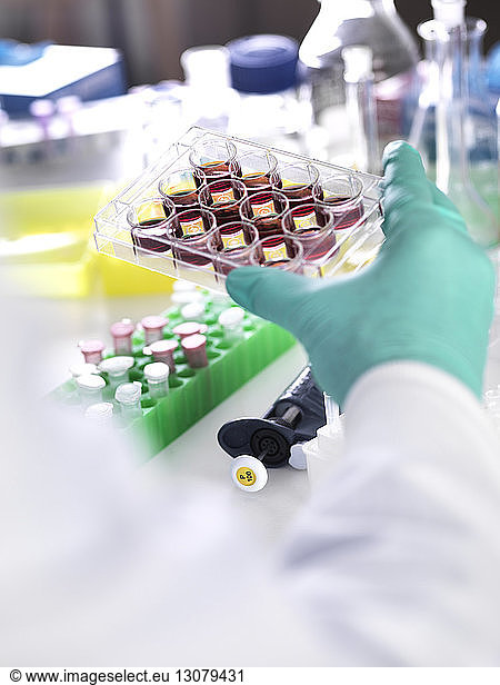 Cropped hand of scientist holding multiwell tray containing stem cells during cancer research in laboratory