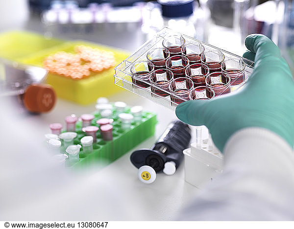 Cropped hand of scientist wearing protective glove holding multiwell tray containing stem cells during cancer research in laboratory