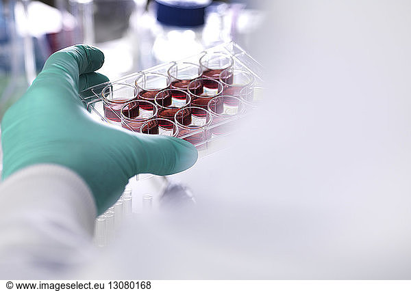 Cropped hand of scientist wearing protective glove holding multiwell tray containing stem cells during research in laboratory