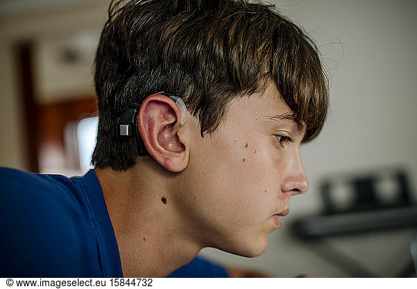 Dark-haired teenager with cochlear implant