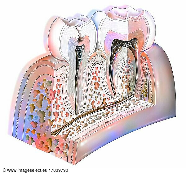Dental plaque: first stage tooth decay.