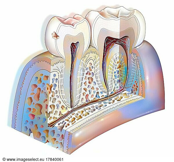 Dental plaque: first stage tooth decay.