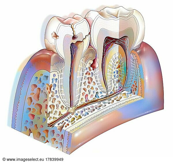 Dental plaque: main pathologies of the teeth: tartar  gingivitis  decay.