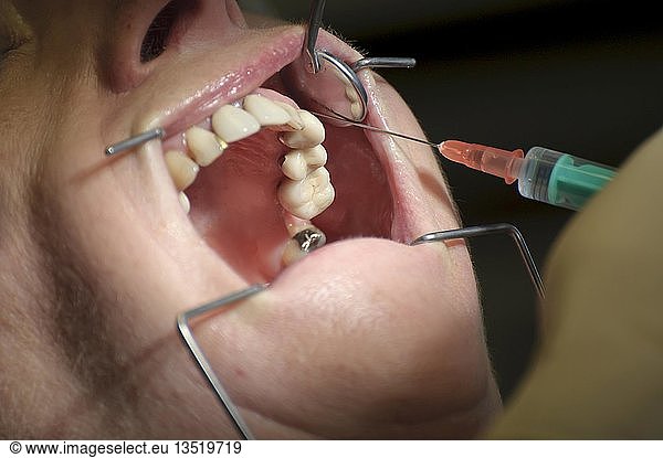 Dental treatment  close-up