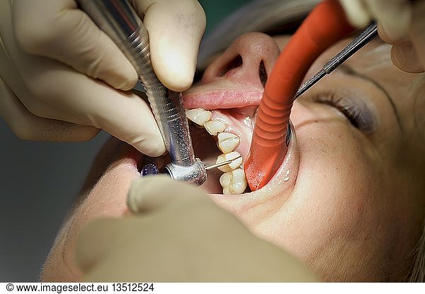Dentist removing dental crowns