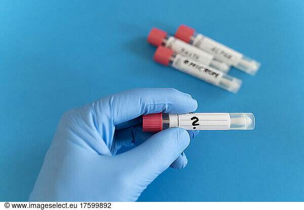 Doctor holding swab tube against blue background in studio