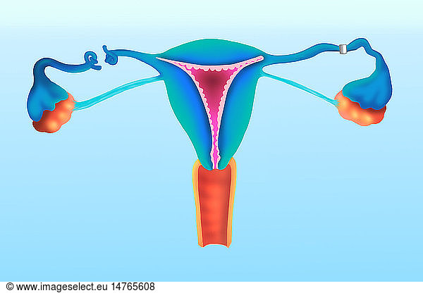 FALLOPIAN TUBE SURGERY FALLOPIAN TUBE SURGERY DRAWING genital female fallopian-tube-surgery-fallopian-tube-surgery-drawing-genital-female