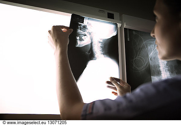 Female doctor examining neck x-ray on diagnostic medical tool